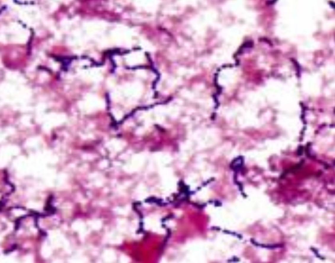 <p>Specimen (microscopically slide):</p><p>• Name of organism:</p><p>• Stain:</p><p>• Sample from: culture or pus or in tissue</p><p>• Morphology</p>