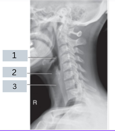 <p>label radiograph</p>