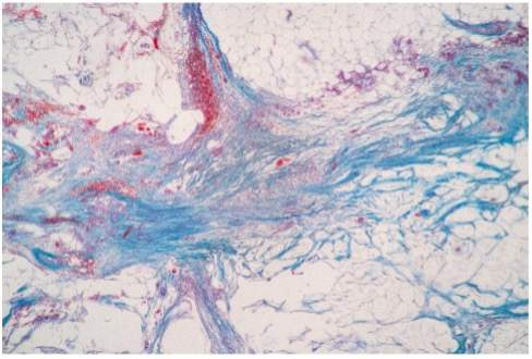 <p><span style="line-height: inherit;"><strong>Function</strong>: Stabilizes positions of the vertebrae, permits expansion and recoiling of organs and structures.</span></p><p><span style="line-height: inherit;"><strong>Structure</strong>: Dense connective tissue dominated by elastin fibers.</span></p><p><span style="line-height: inherit;"><strong>Location</strong>: Trachea, artery walls, elastic cartilage, vocal cords.</span></p>
