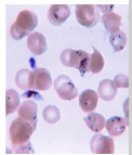 <p>- Obligate intracellular blood sporozoan</p><p>- Primarily tropical and sub-tropical (limited by vector)</p><p>- Infection transmitted by female Anopheles mosquitos</p><p>- Four (five) human pathogenic spp: P. falciparum, P. vivax, P. malariae and P. ovale (P. Knowlesi) - also malaria in birds, lizards, rodents, primates.</p><p>- Most serious disease caused by Plasmodium falciparum (cerebral or malignant malaria)</p><p>.</p><p>Species differentiation includes:</p><p>- Morphology and staining characteristic of various stages (Trophozoite, schizont, gametocyte)</p><p>- Number of merozoites in blood schizont (a sexual stage)</p><p>- Appearance of infected blood cell</p><p>- Pathology: severe, benign, cerebral, anaemia</p><p>.</p><p>out of all the species, the one thats important is P. falciparum, this is the most common and deadly</p>