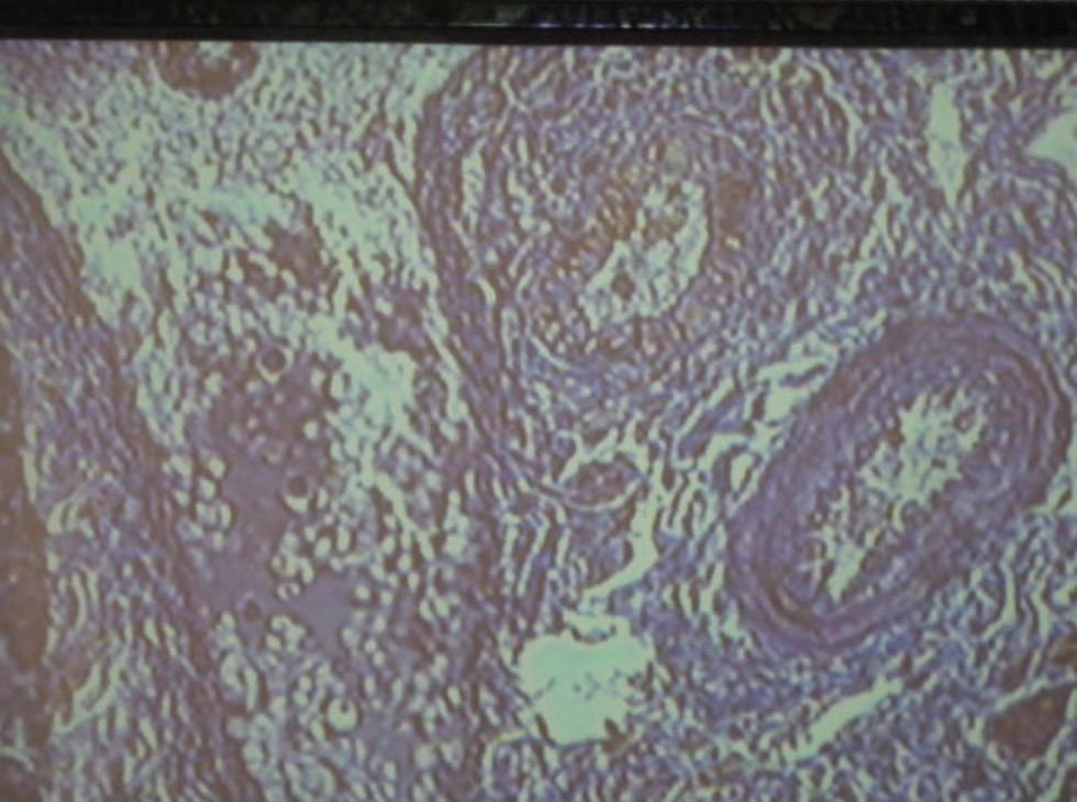 term image