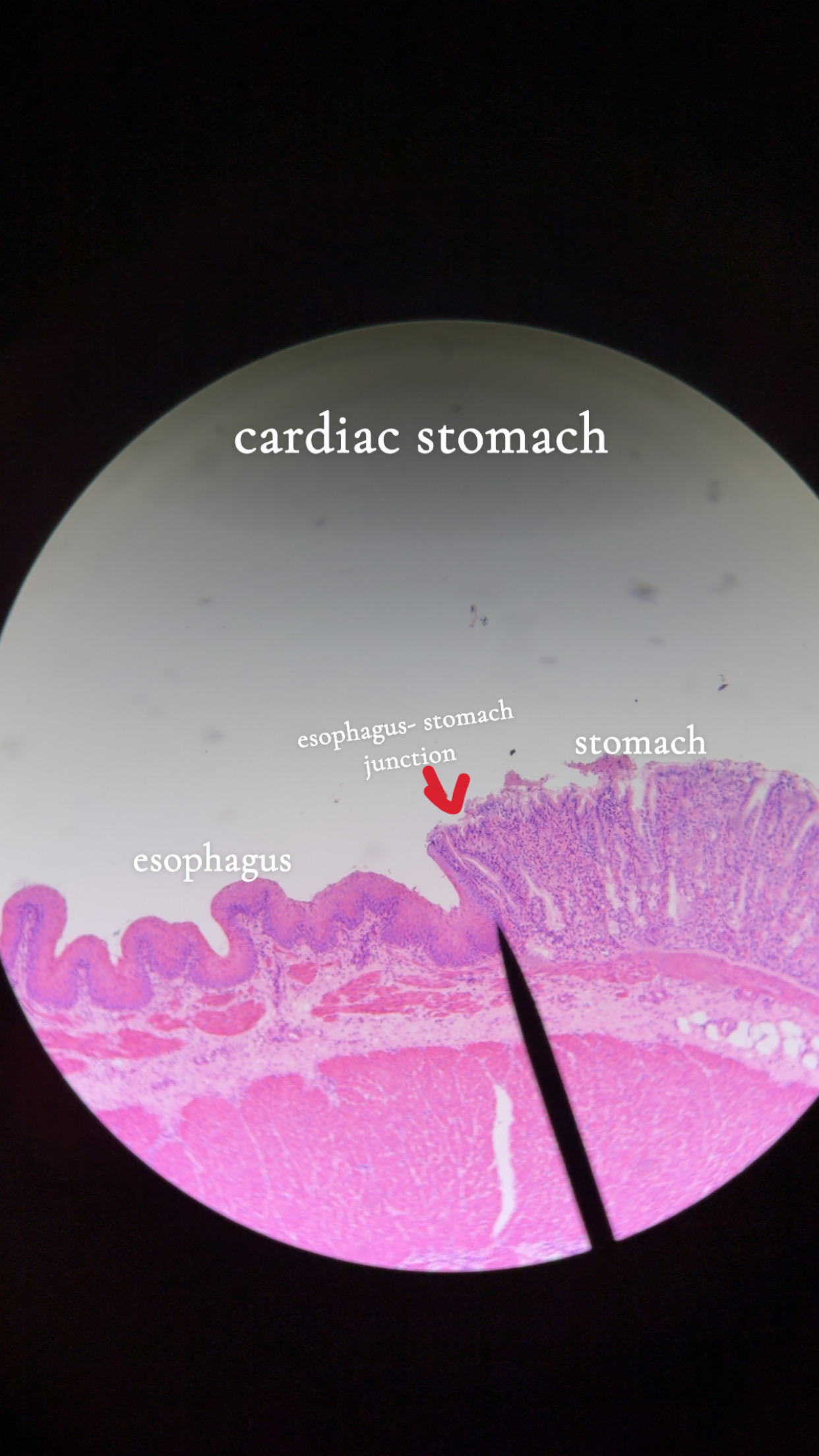 <p>surrounds cardiac orifice where food enters the stomach</p><p></p><p>stratified squamous: esophagus </p><p></p><p>simple columnar: stomach </p>