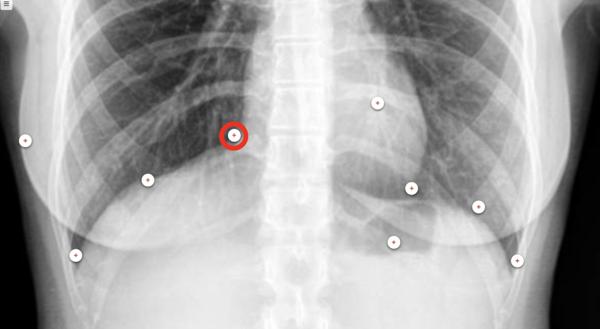 <p>what structure is the red circle labeling?</p>