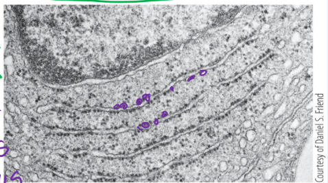 <p>What kind of micrograph is this?</p>