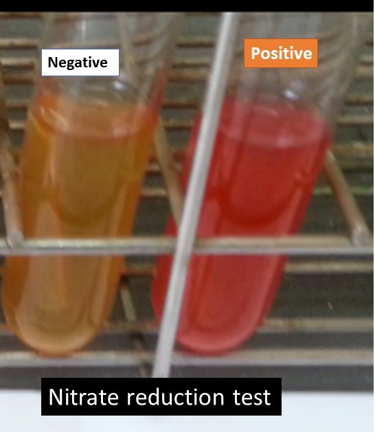 <p>Nitrate reduction test</p>