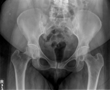 <p>Is this image hung correctly?</p>