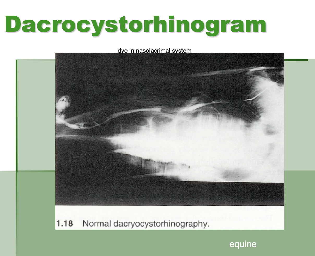 <p>putting dye in the nasolacrimal system </p>