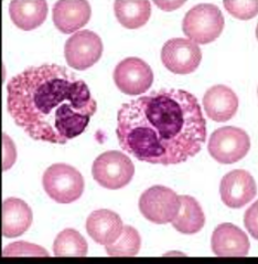 <p>Eosinophils</p>