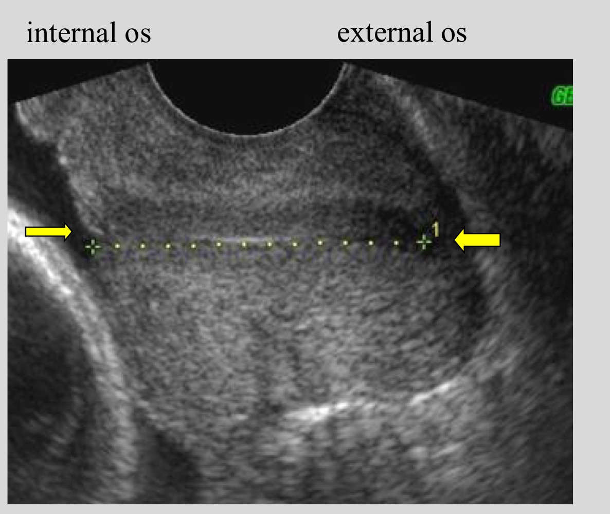<p>Internal os to external os</p>