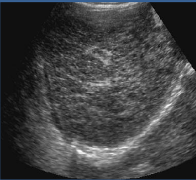 <p>describe the echogenicity and echotexture of this liver</p>