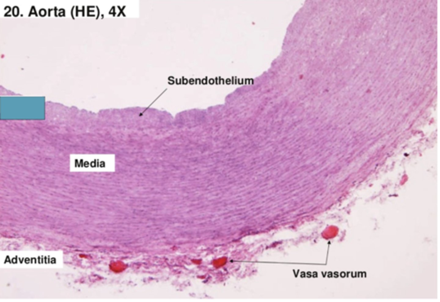 <p>Identify the layer of the vessel</p>