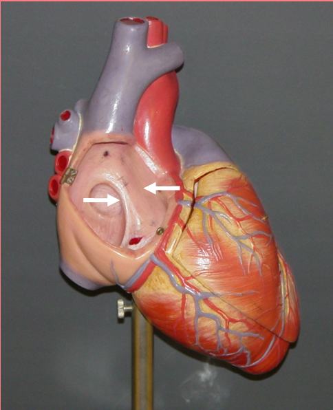 <p>Interatrial septum (wall)</p><p> • partitions the atria </p><p>• Fossa ovalis </p><p>– remnant of the fetal foramen ovale</p>