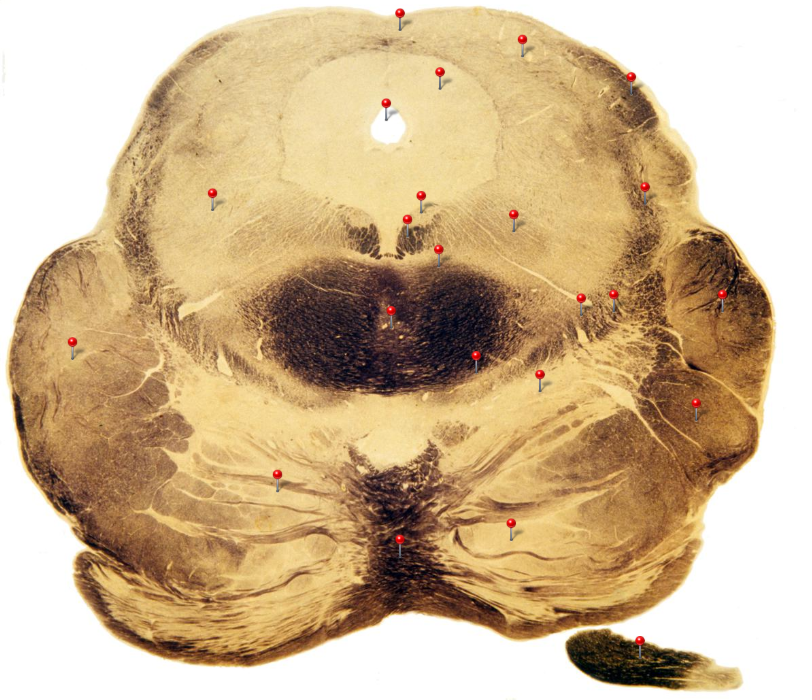 term image