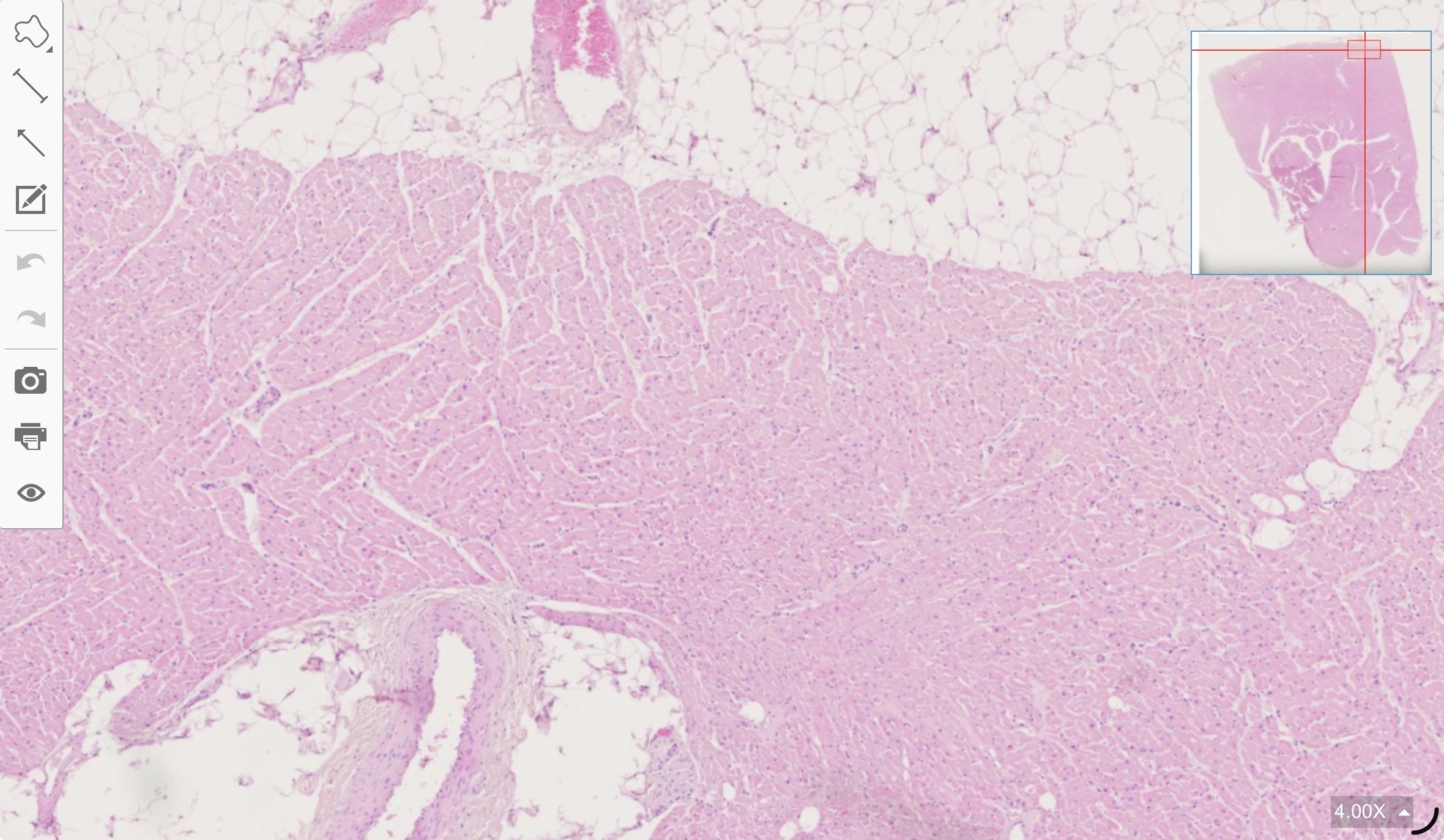 term image
