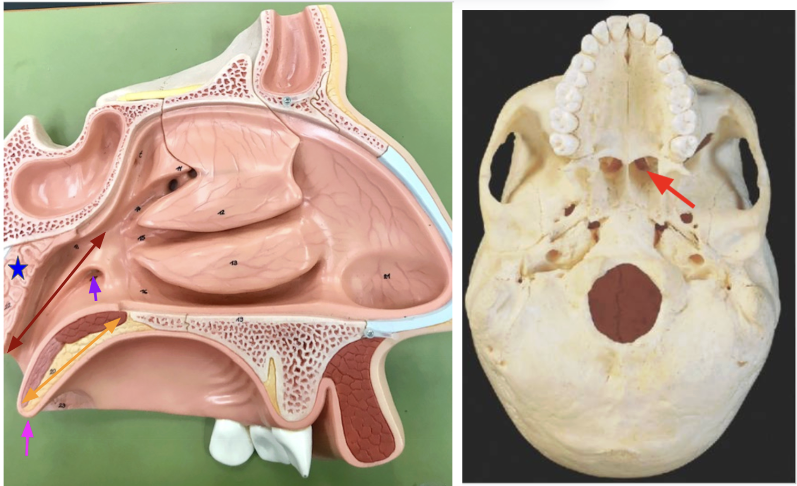 <p>Dark Red: Nasopharynx</p><p>Bright red: posterior nasal apertures</p><p>Yellow: Soft palate (tissue area)</p><p>Pink: Uvula - Prevents food from entering the nasal cavity when eating (bc it raises upward).</p><p>Blue: Pharyngeal tonsils</p><p>Purple: Auditory tube - Connect the ear, nose, and throat</p>