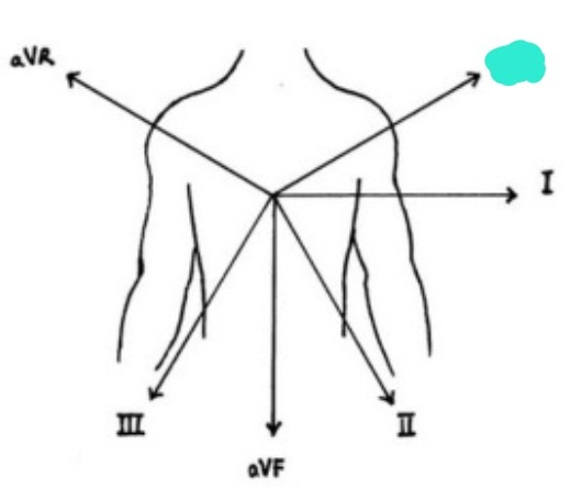 <p>left arm &amp; right arm/left leg 흘러가는 전기적 흐름 보여줌</p>