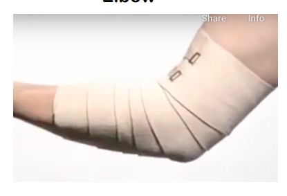 <ul><li><p>begin mid-forearm, wrapping a few times</p><p></p></li><li><p>wrap up the arm, covering half of previous wrap as you go along</p><p></p></li><li><p>wrap to mid upper arm and secure with fastener.</p></li></ul><p></p>