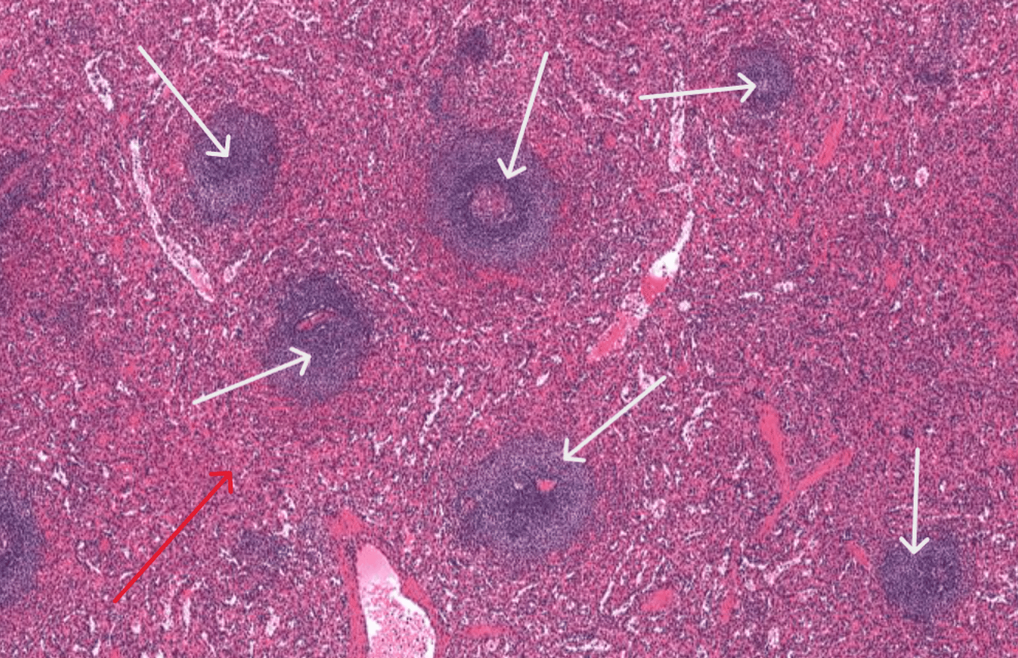 <p>What are the white arrows pointing to?</p>