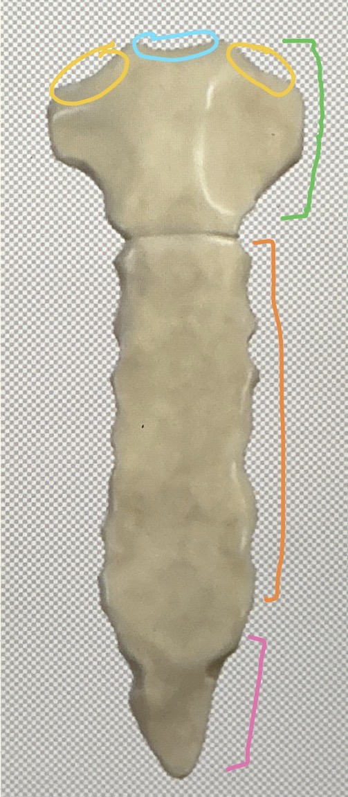 <p>what is the yellow circled structure?</p>