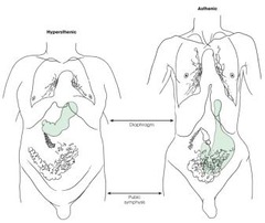 <p>Sthenic, Hyposthenic, Asthenic, Hypersthenic.</p>