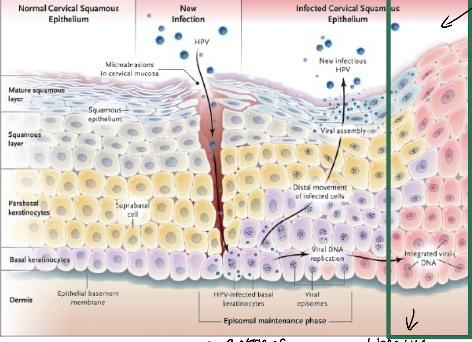 <ul><li><p><strong>Initial infection in the basal layer of squamous epithelial cells, primarily due to micro-abrasions in mucosa</strong> i.e. the cervix, </p></li><li><p><strong>Followed by viral replication i.e. in HPV-infected basal keratinocytes and integration into the host genome</strong>. </p></li><li><p>This can lead to the expression of oncogenes, <strong>which disrupt normal cell cycle regulation,</strong> promoting uncontrolled cell proliferation by cells entering the S phase and potential tumorigenesis. </p></li><li><p><strong>Cells divide and differentiate as they move up,</strong> with distal movement of infected cells ultimately allowing for the release of new infectious HPV particles</p></li></ul><p></p>