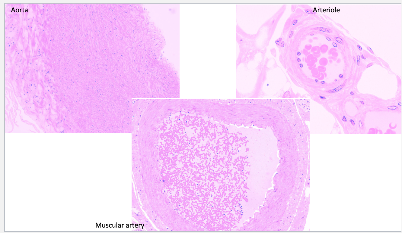 <p>Distinct fibers in the tunica intima</p>