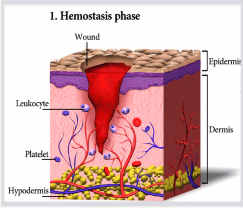 <ol><li><p>Vasoconstriction; blood vessels constrict to help clotting</p></li><li><p>Platelets arrive</p></li><li><p>Leukocytes (WBCs) arrive to fight off infection</p></li></ol><p></p>