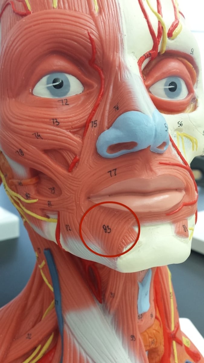 <p>action: draws lower lip downward &amp; lateral</p><p>*innervated by CN VII (Facial n.)</p>