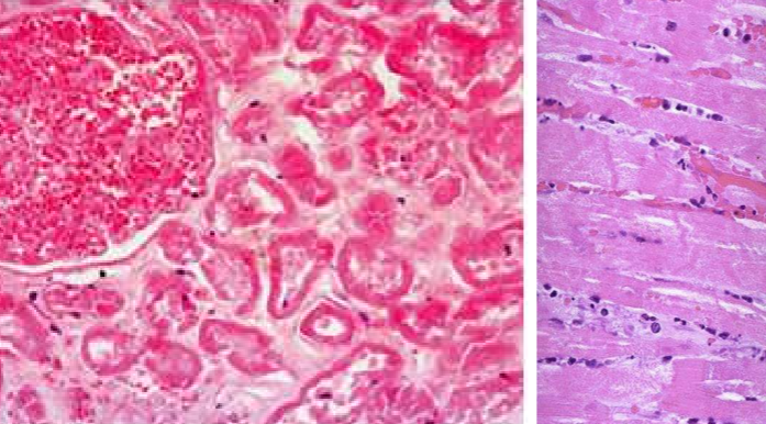 <ul><li><p>kontūrai išlieka</p></li><li><p>branduolio nematyti</p></li></ul><p></p>