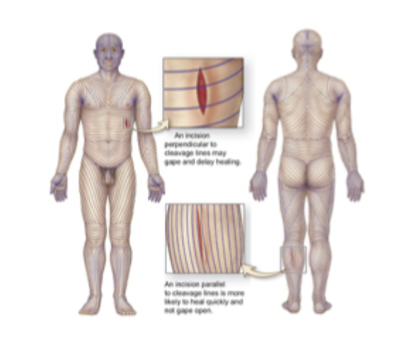 <p>lines of cleavage</p>