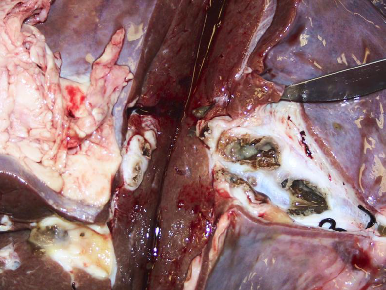 <p><span style="color: blue;">Acute fluke disease</span></p>