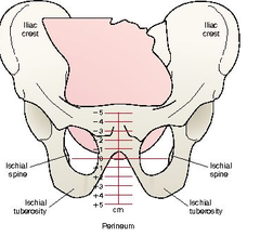 <p>Describes the positions of the baby's head in relation to the maternal pelvis during labor. Measured in centimeters above or below the ischial spine.</p>