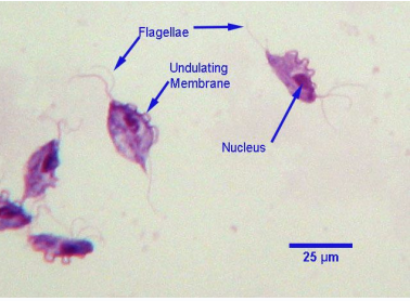 <p>What parasite is this. Sample is from vaginal swabs of aborting cows </p>