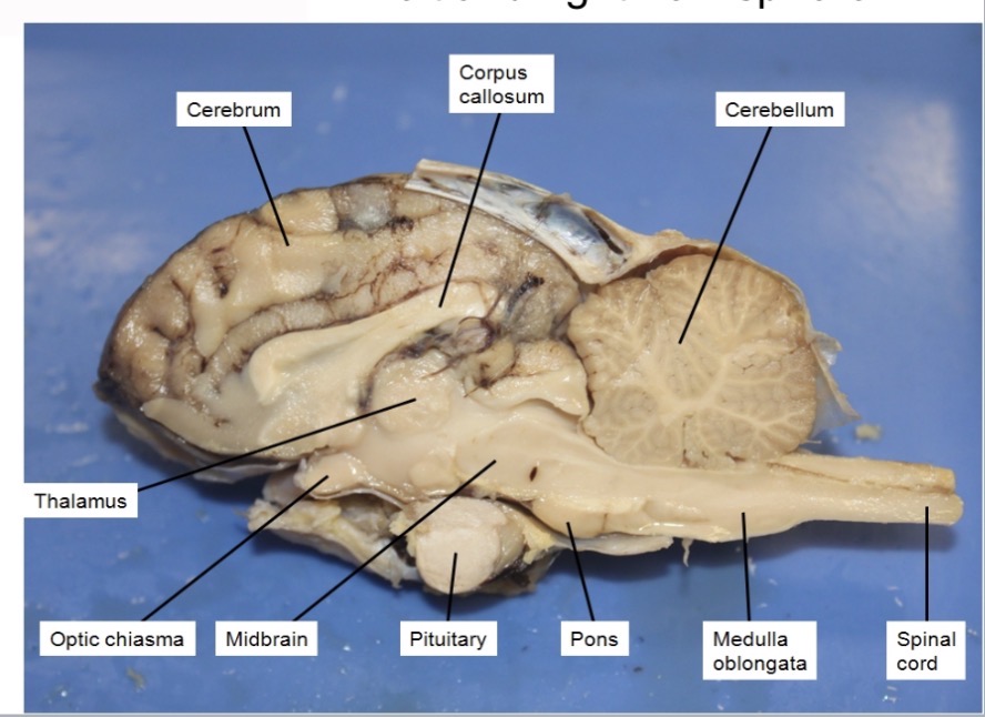 <p>involved in the coordination of motor movements as well as basic facets of memory and learning </p>