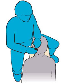 <p><strong>Torso position</strong></p><ul><li><p>Top right of headrest</p></li><li><p>Midline of torso — right temple region of patient’s head</p></li></ul><p><strong>Leg position</strong></p><ul><li><p>Straddle corner of headrest</p></li></ul><p><strong>Arm positions</strong></p><ul><li><p>Right hand across corner of patient’s mouth</p></li><li><p>Left hand and wrist above patient’s nose and forehead</p></li></ul><p><strong>Line of vision</strong></p><ul><li><p>Straight ahead into patient’s mouth</p></li></ul><p></p>