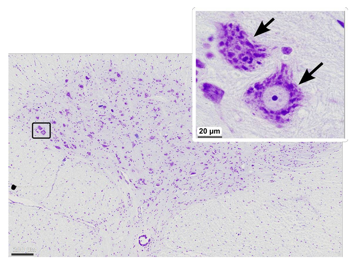 <p>A19) What is the general name of this type of cell?</p>