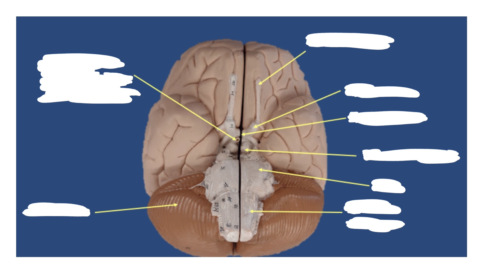 <p><a target="_blank" rel="noopener noreferrer nofollow" class="link" href="https://assets.knowt.com/user-attachments/69e405dc-ff57-44a5-a73a-6f5bdd21a107.jpg" data-prevent-progress="true">https://assets.knowt.com/user-attachments/69e405dc-ff57-44a5-a73a-6f5bdd21a107.jpg</a></p>