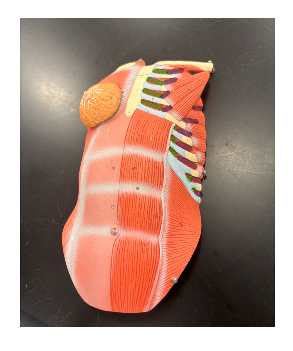<p>name the muscles highlighted in blue and their function</p>