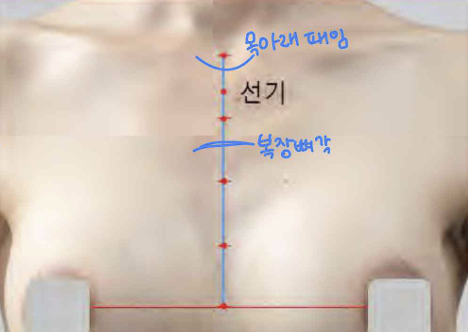 <p>앞정중선 위, 목아래패임 아래 1寸</p>