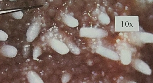 <p>what is being pointed to on this sea star</p>