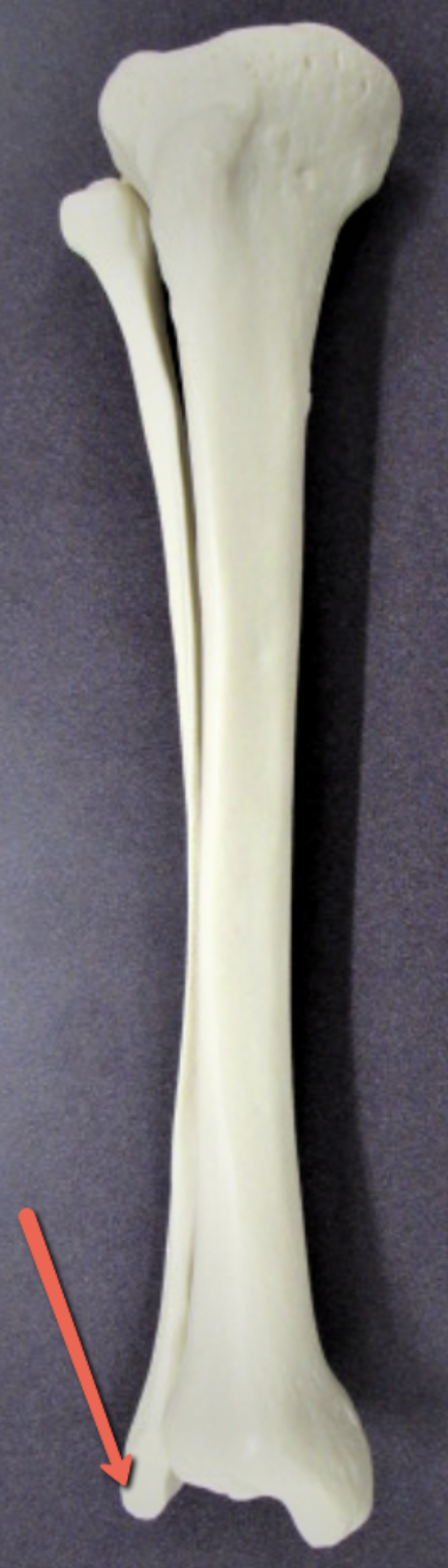 <p><strong>Identify the bone marking indicated by the pointer.</strong></p>