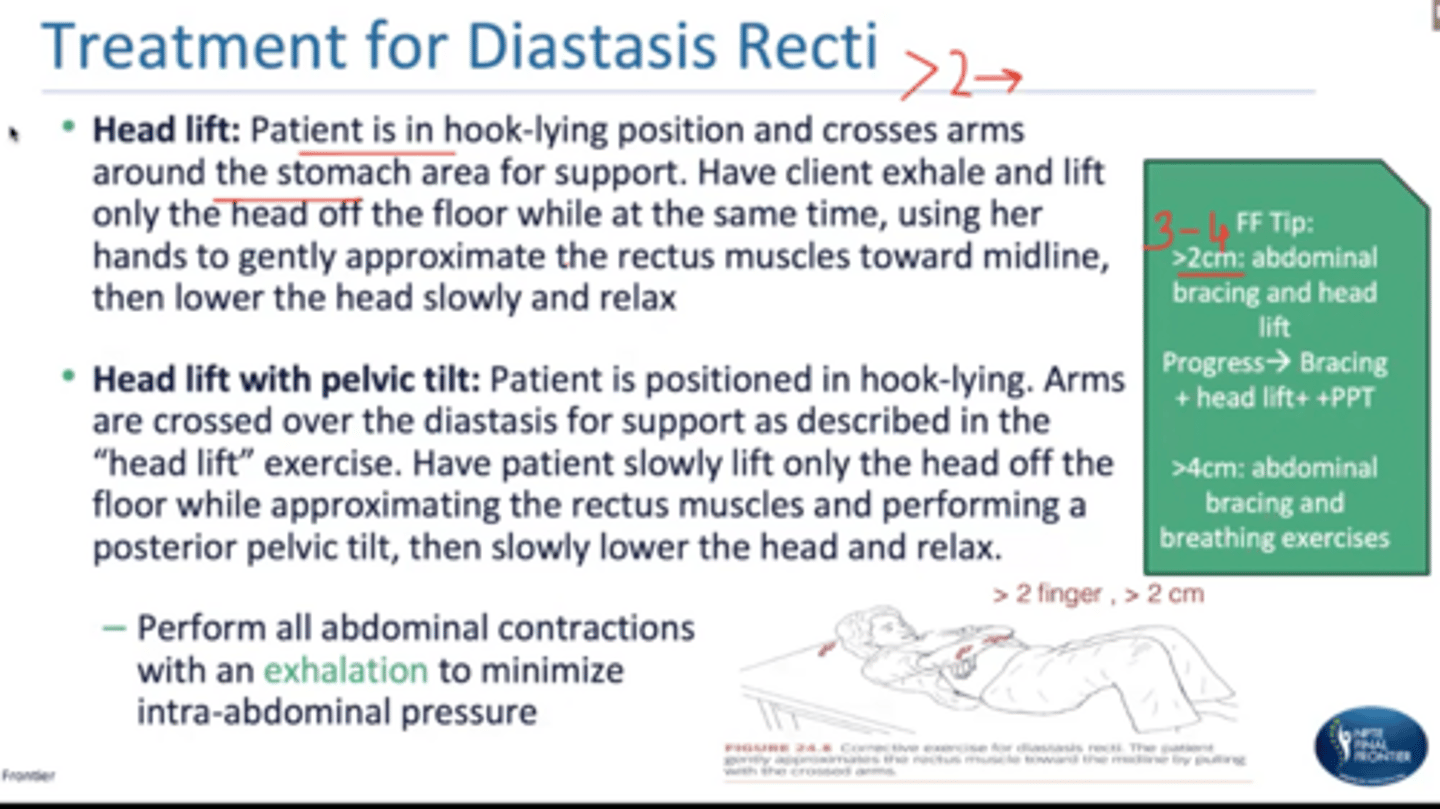<p>>2 cm (don't do any aggressive...avoid curl ups, leg lifts, fire hydrants)</p>