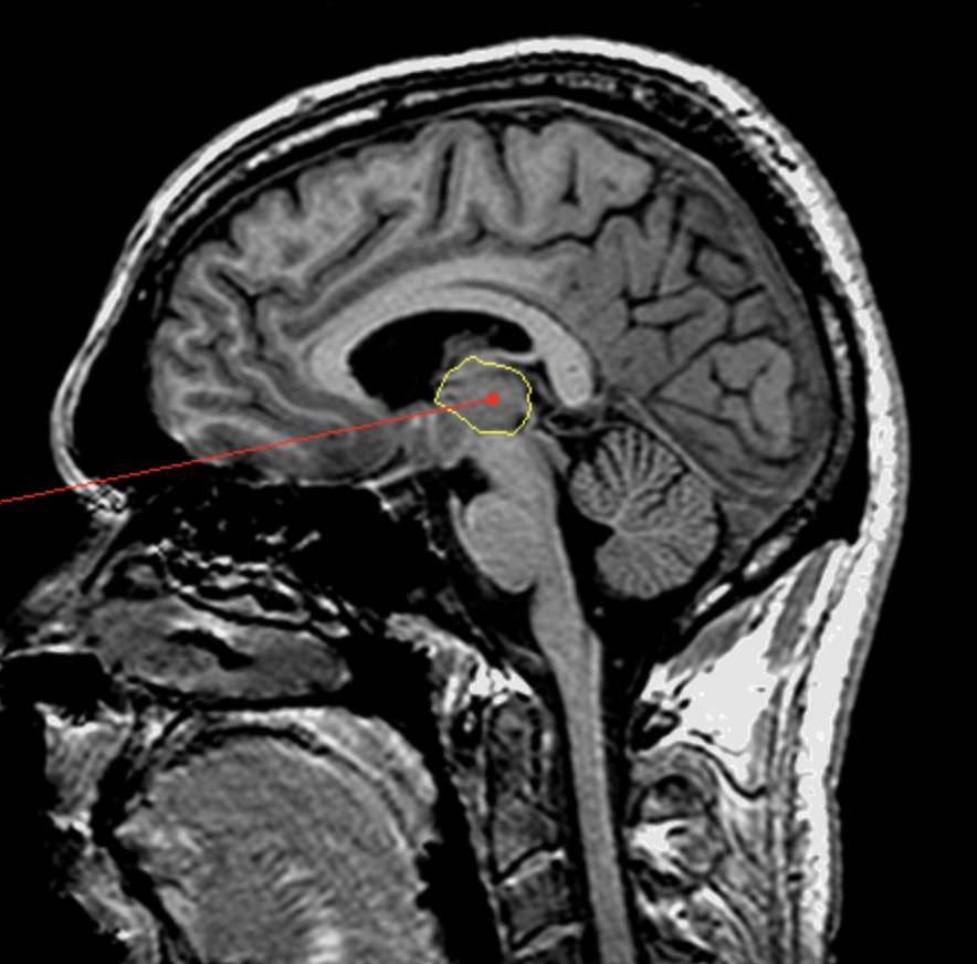 <p>What is the area highlighted called?</p>