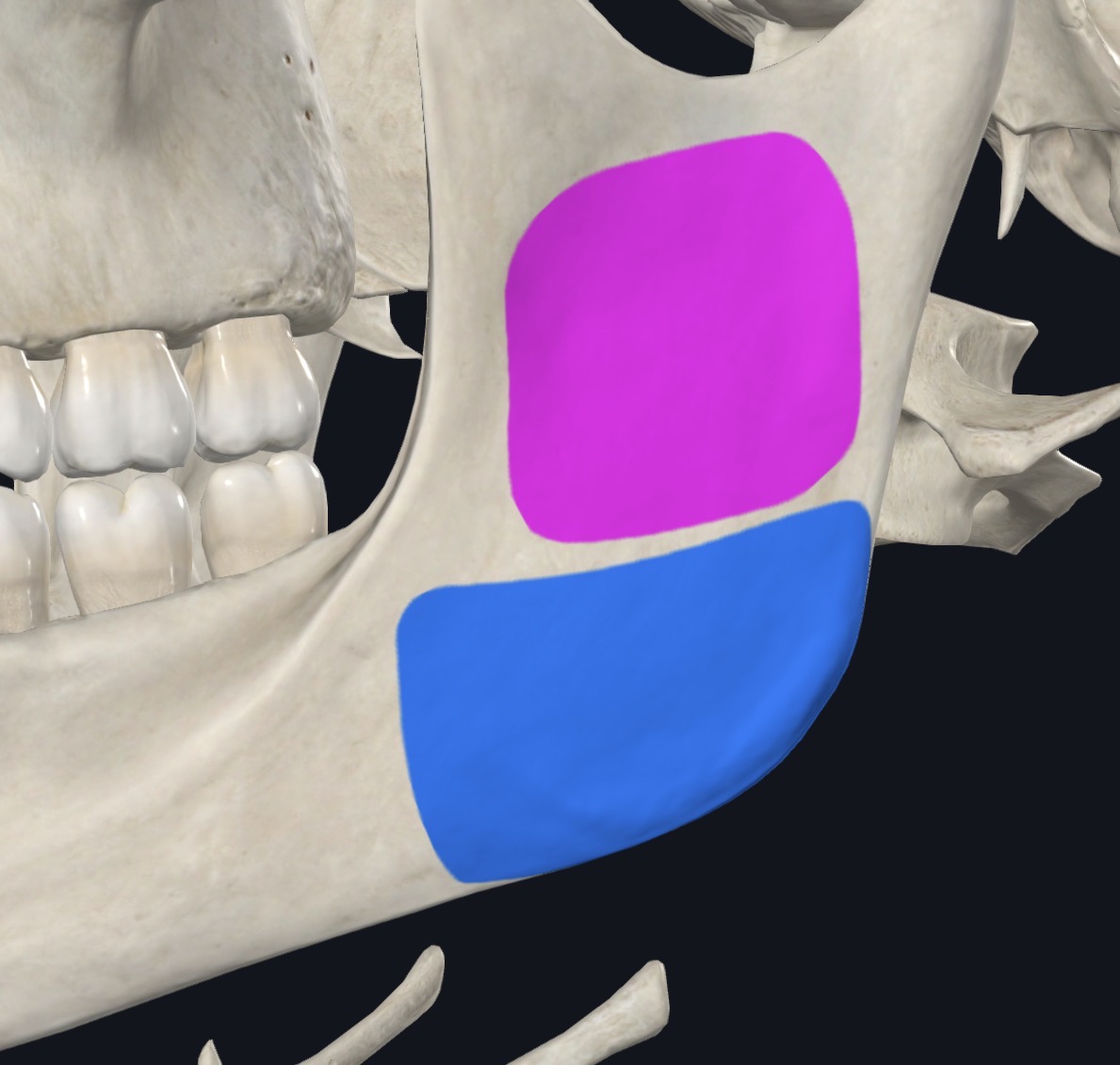 <p>Angle and lateral surface of ramus of mandible</p>