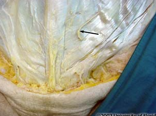<p>what nerve is being indicated to in the image</p>