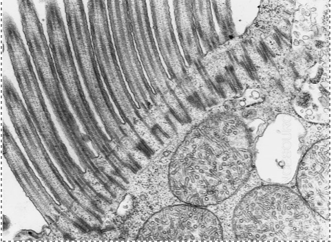 <p>identify the apical specialization in the FoV</p>
