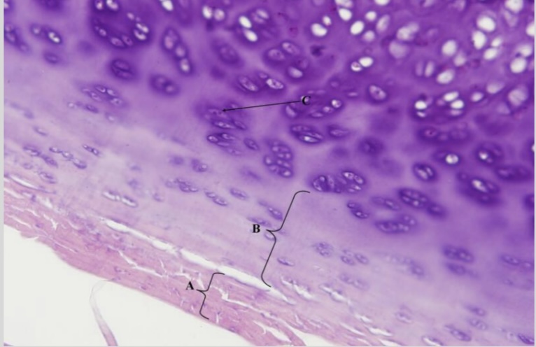 <p>NTK: what type of cartilage is this </p>