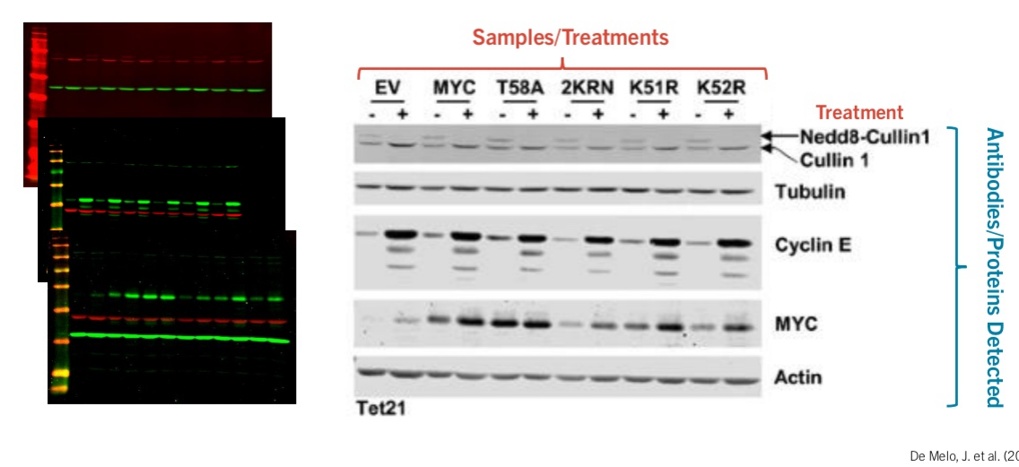 <p>1. Proteins are separated by SDS-PAGE (so they can be removed from the gel and can bind to antibodies) and transferred to a solid-support membrane (blotting).</p><ul><li><p>side note: however the polymer sheet has high affinity to all proteins (so any thing that is exposed with be bound to this sheet), including antibodies, so not interactions would happen</p></li></ul><p>2. The membrane is exposed to a protein-solution (e.g. milk or BSA) to bind random proteins to any unused regions of the membrane.</p><ul><li><p>like parking lot with lots of cars, no more parking spots</p></li></ul><p>3. A primary antibody, specific for your POI, is added to recognize linear sequences of amino acids.</p><ul><li><p>binds to the antibody</p></li></ul><p>4. Secondary antibodies are specific for the Fc domain of the primary antibody and are attached to a fluorescently labeled tag or enzyme that generates a chemi-luminescent, visible product.</p><ul><li><p>binds to the primary antibody already bound to the antigen, amplifying the signal and helping make it more visible</p></li></ul><p>5. This may show if your POI is present in the sample and its approximate size based on where it migrated on the gel.</p><ul><li><p>signals will be seem if your POI is present in the gel</p></li></ul><p></p><p></p><p>Other information</p><ul><li><p>tubular and actin are loading controls: has the same level fo dark band = same amount of protein eachh time</p></li><li><p>To be able to draw conclusions</p></li><li><p>Less expression in lysine (maybe some effect more studying need to be done there)</p></li></ul><p></p>
