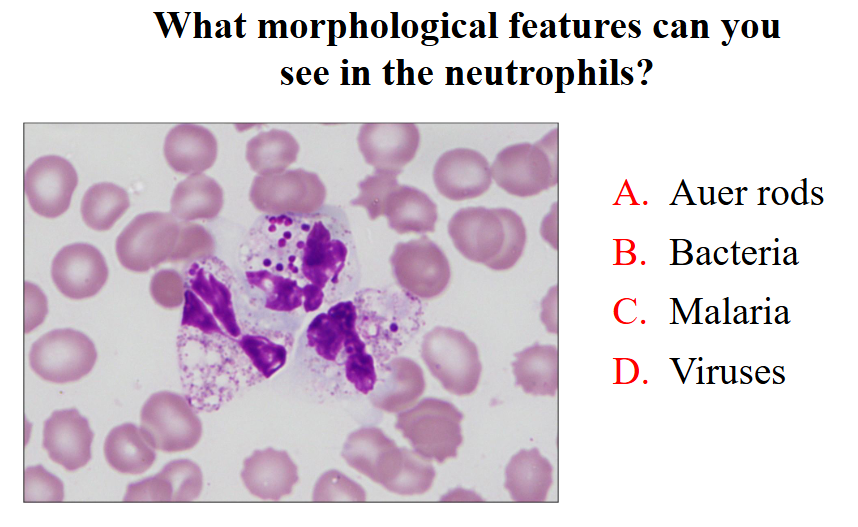<p>What morphological features can you see in neutrophils</p>