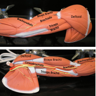 <p><strong>Origin: </strong>Coracoid process.<strong><br>Insertion: </strong>Radial tuberosity.<strong><br>Action: </strong>Flexes forearm.<strong><br>Synergist: </strong>Brachialis.</p><p><span style="color: rgb(223, 0, 0);"><strong>Antagonist: </strong></span><span style="color: rgb(248, 248, 248);">Triceps brachii.</span></p>